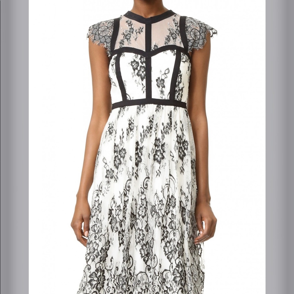 Parker Black and White Lace Midi Dress